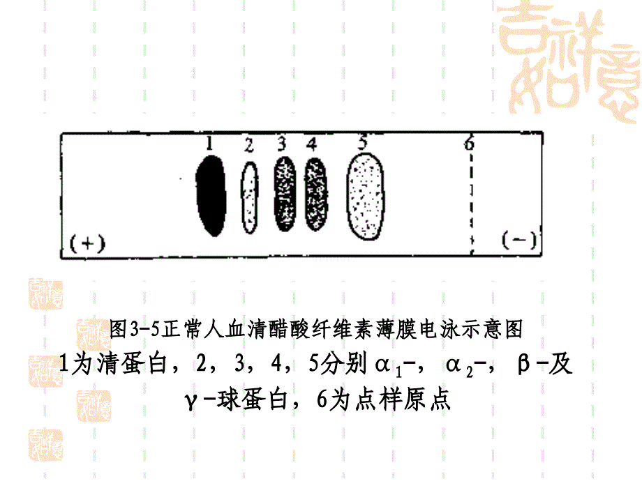 血清蛋白的醋酸薄膜电泳_第4页