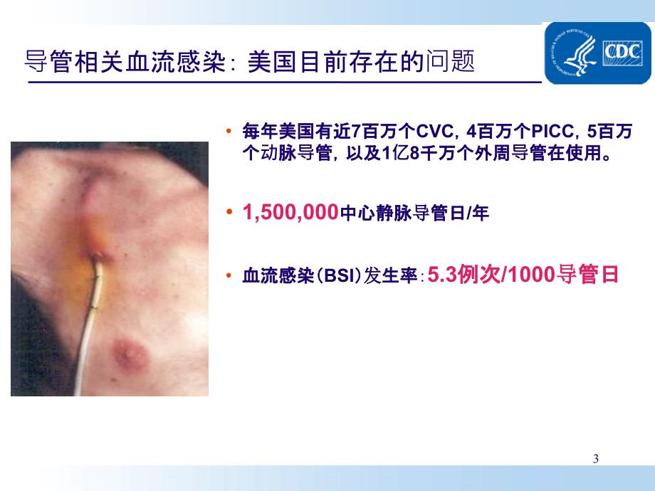 预防导管相关性血流感染(CDC指南解读)...ppt_第3页