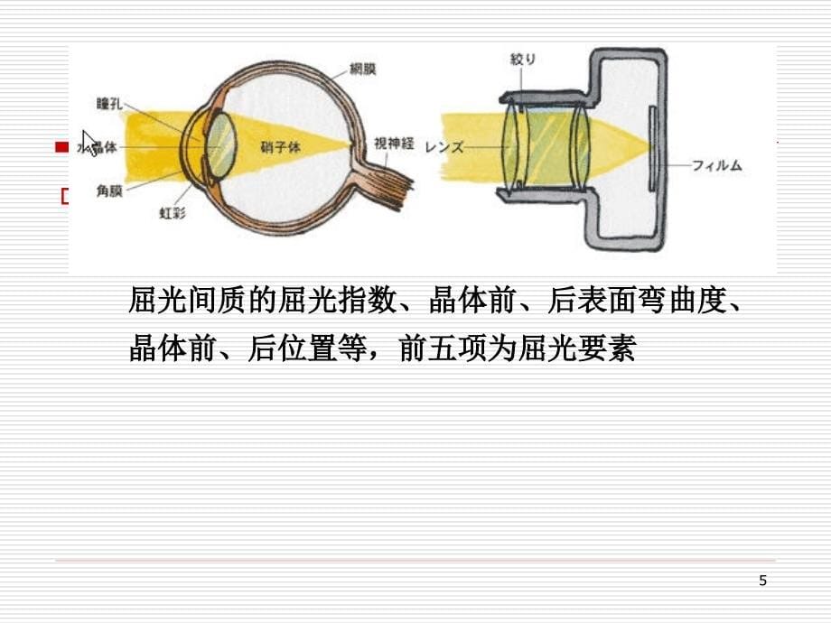 斜视、弱视中的验光配镜原则_第5页