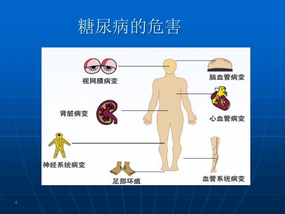 慢性疾病培训课件知识讲座_第4页