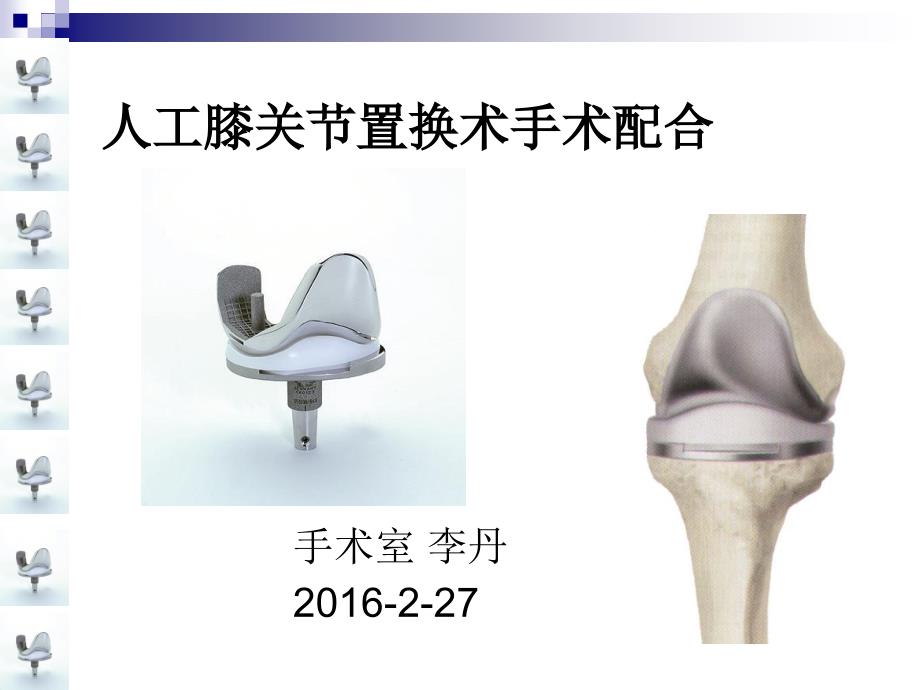 人工膝关节置换术手术配合_第1页