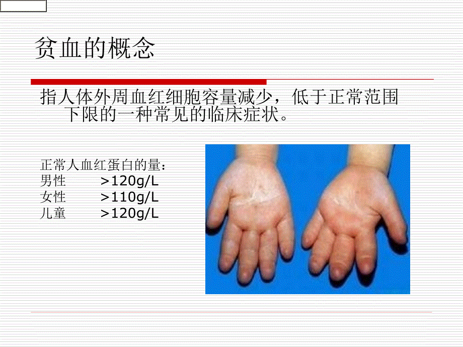 肾性贫血-病友会_第2页