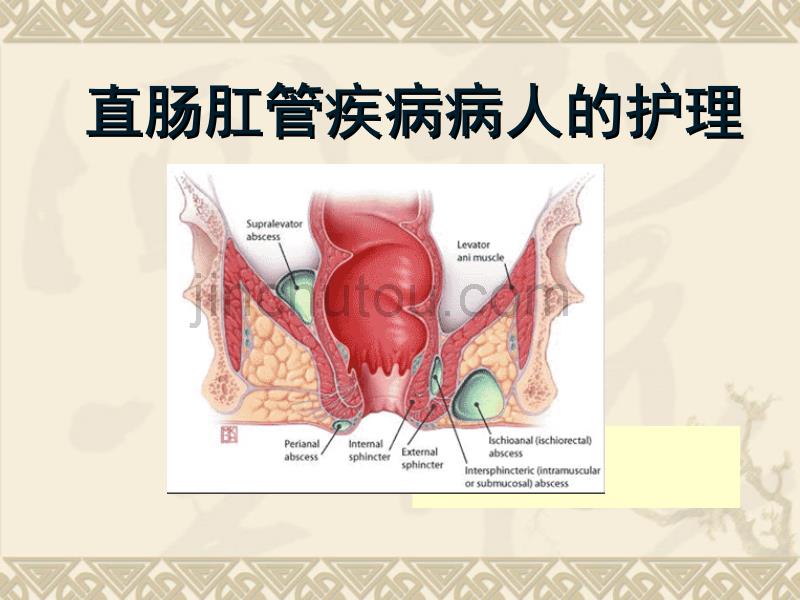 直肠肛管疾病病人的护理_第3页