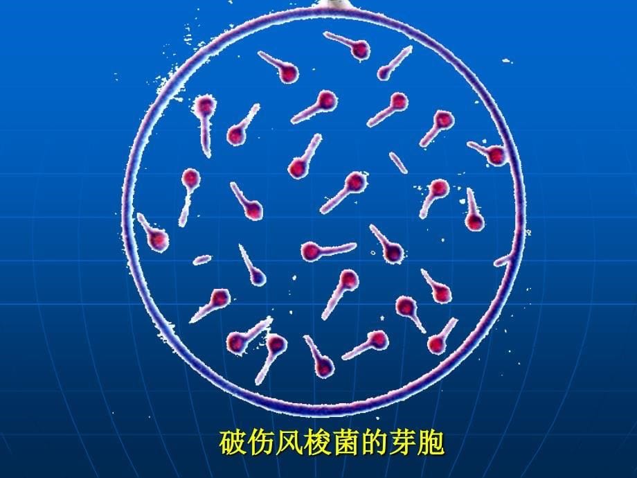 重庆科创职业学院第九章+new厌氧性细菌_第5页