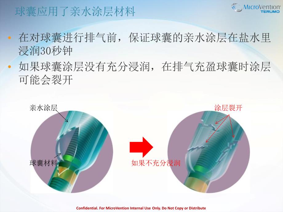 球囊使用要点_第3页