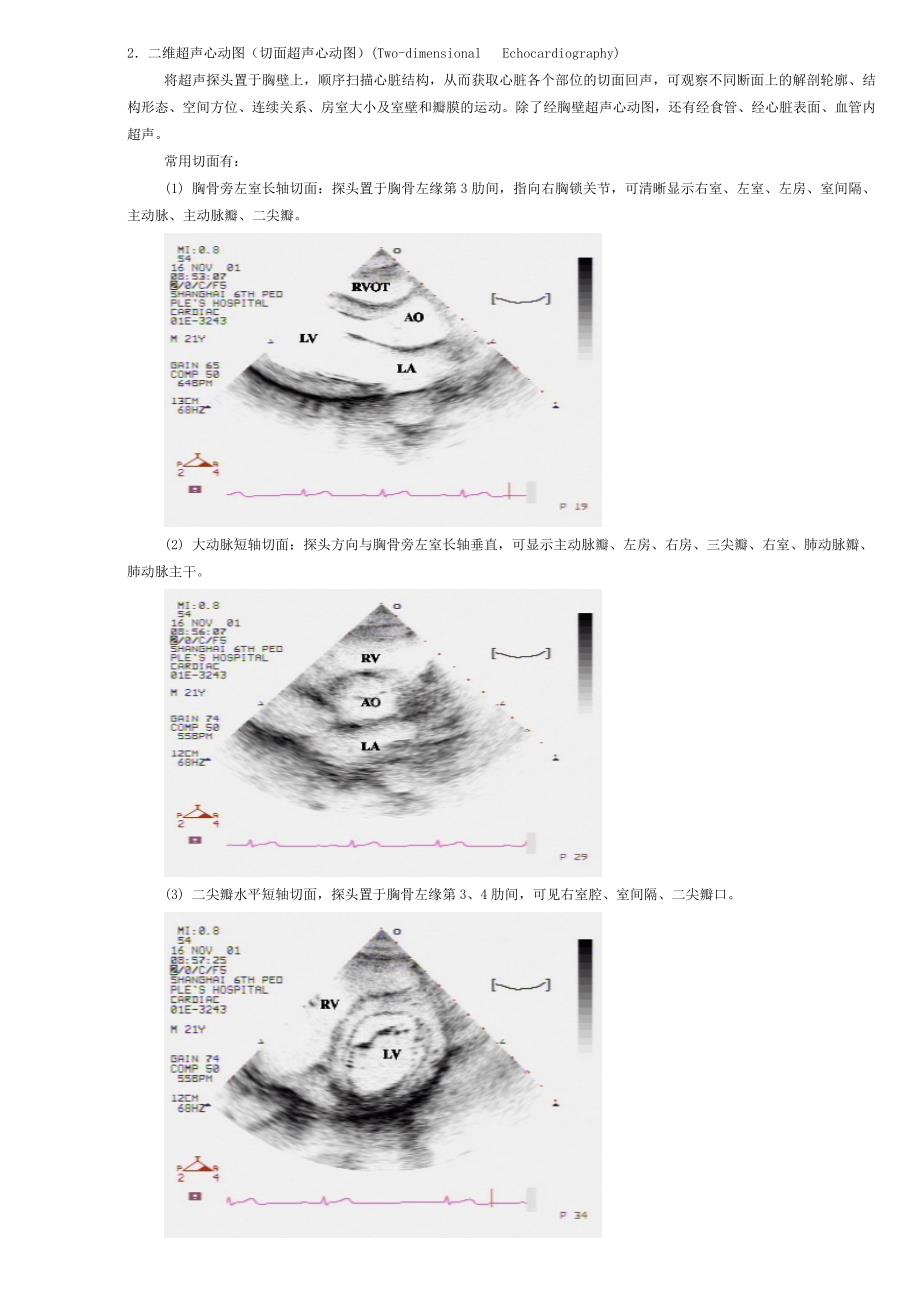 超声心动图学_第2页