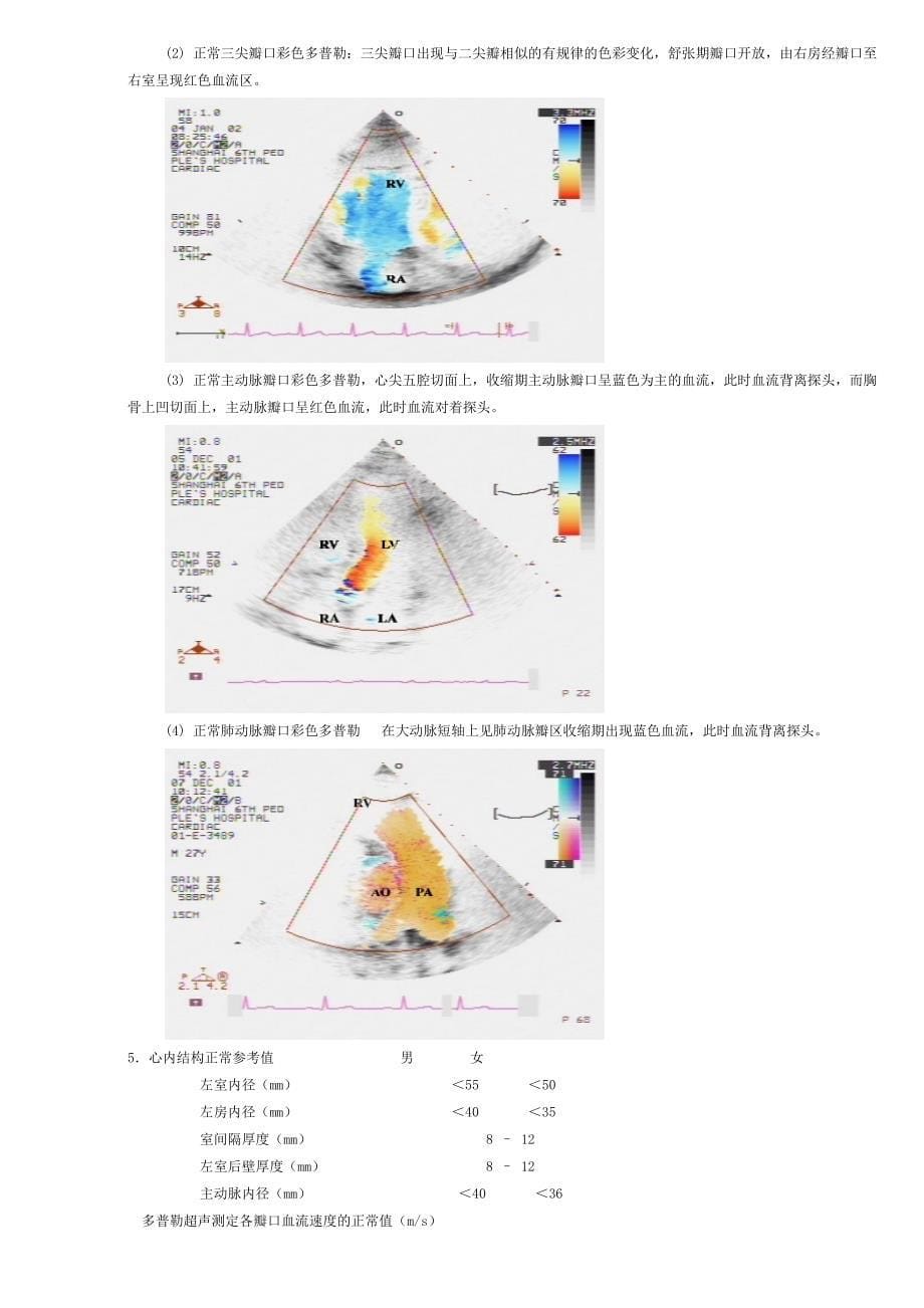 超声心动图学_第5页