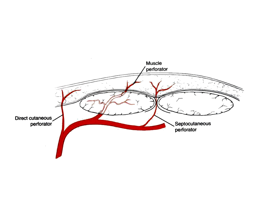 1 穿支皮瓣的解剖与进展_第4页