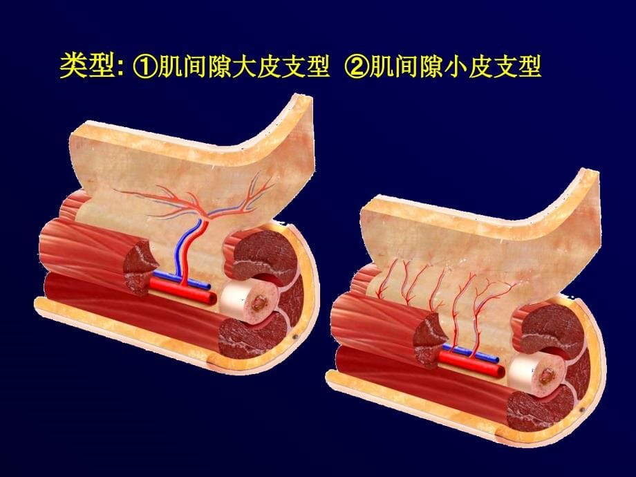 1 穿支皮瓣的解剖与进展_第5页