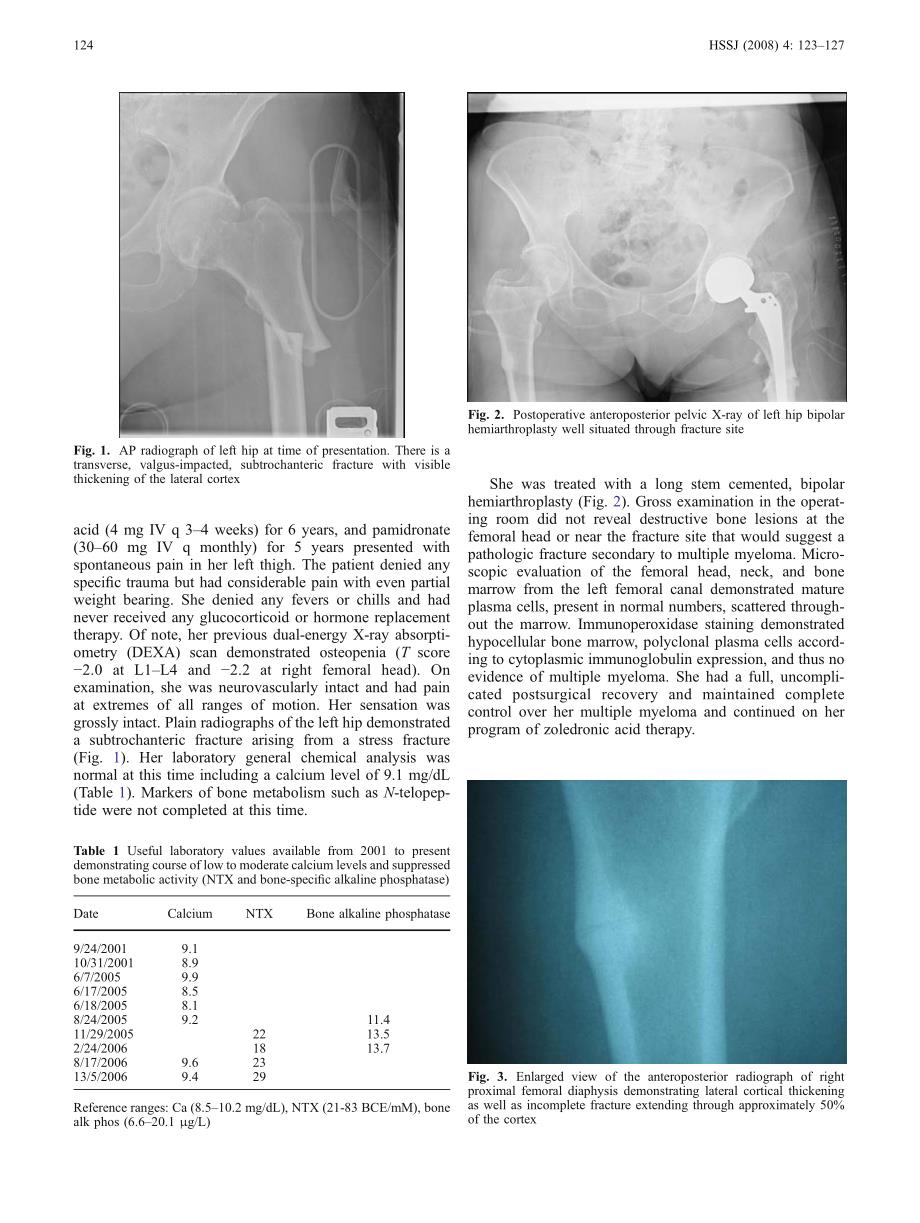 英文：一例长期应用帕米磷酸和唑来膦酸发生股骨骨折的病例报道_第2页