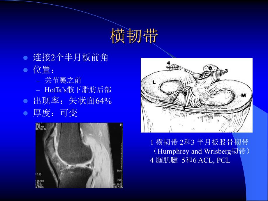 MRI在膝关节创伤的应用_第4页