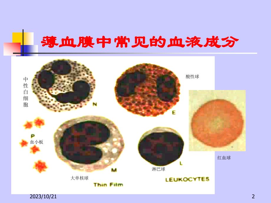 显微镜下疟原虫形态鉴别特征_第2页