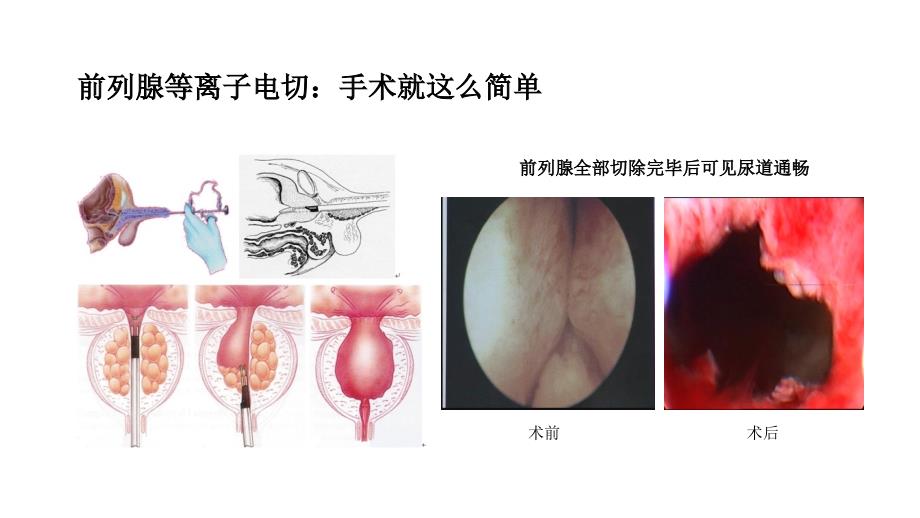 东方医院泌尿外科科室介绍_第4页