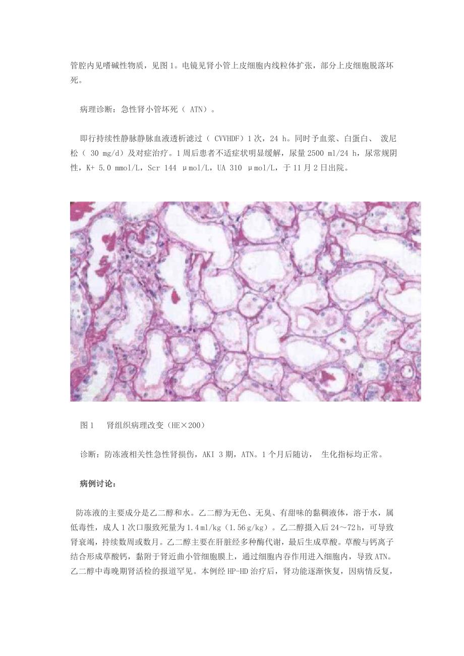 防冻液致急性肾损伤一例_第2页