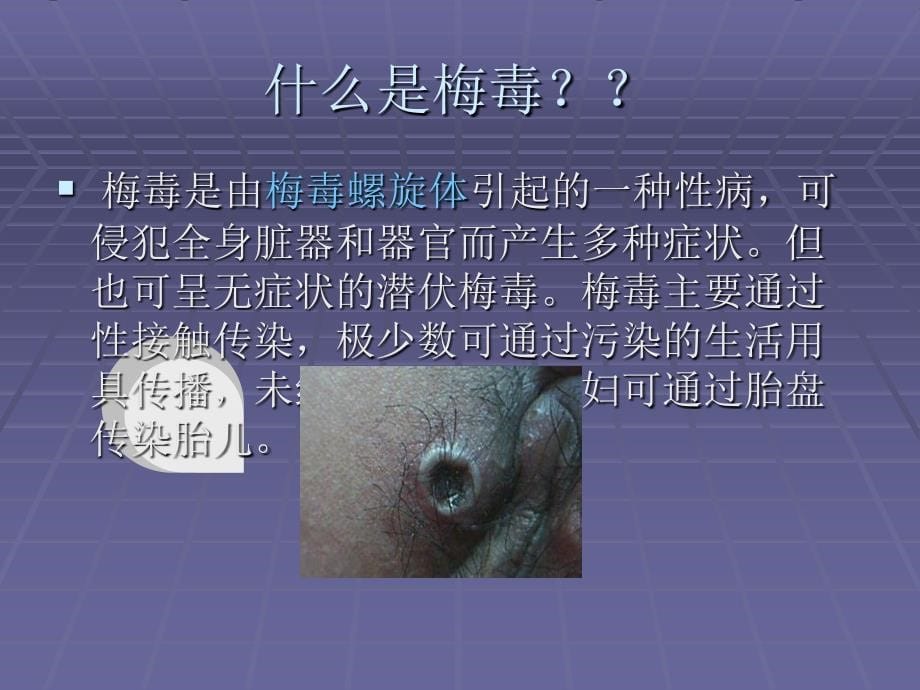 常见性病临床症状与鉴别PPT课件_第5页