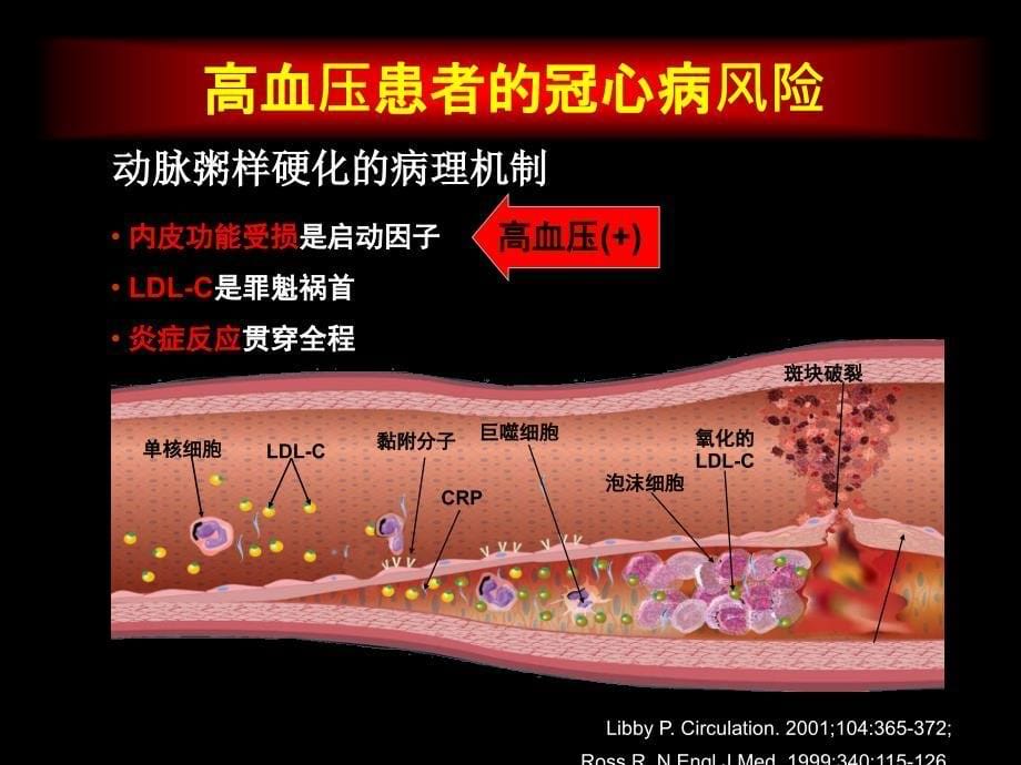 高血压与动脉粥样硬化_张运_第5页