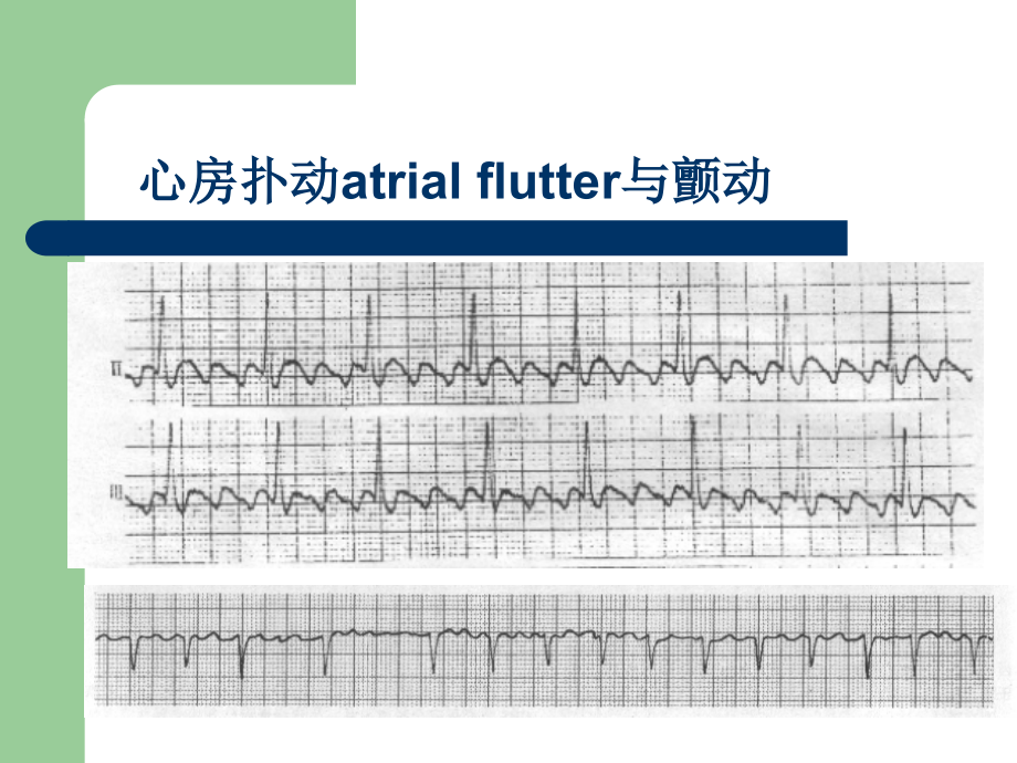 心电图基础知识 (3)_第3页