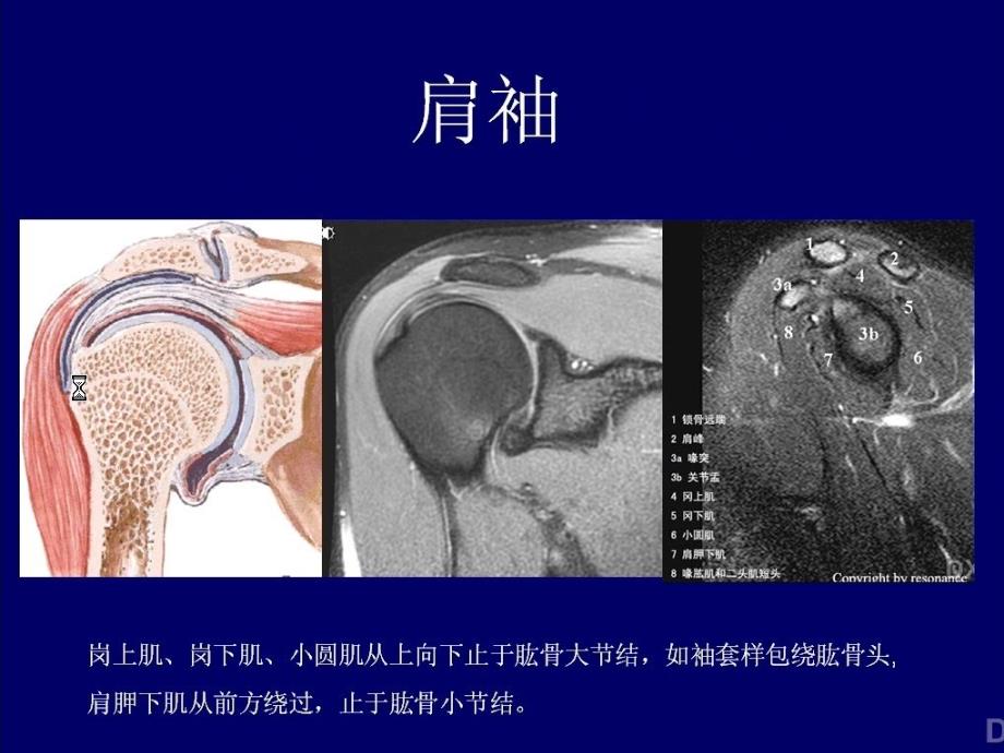 肩关节MRI影像诊断_第3页