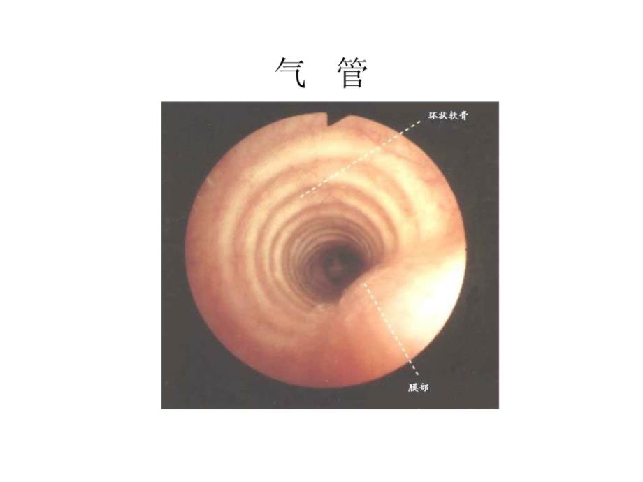 纤支镜的临床图谱_第4页