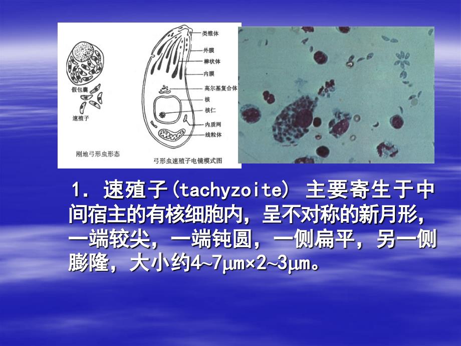 刚地弓形虫（toxoplasma gondii）_第3页