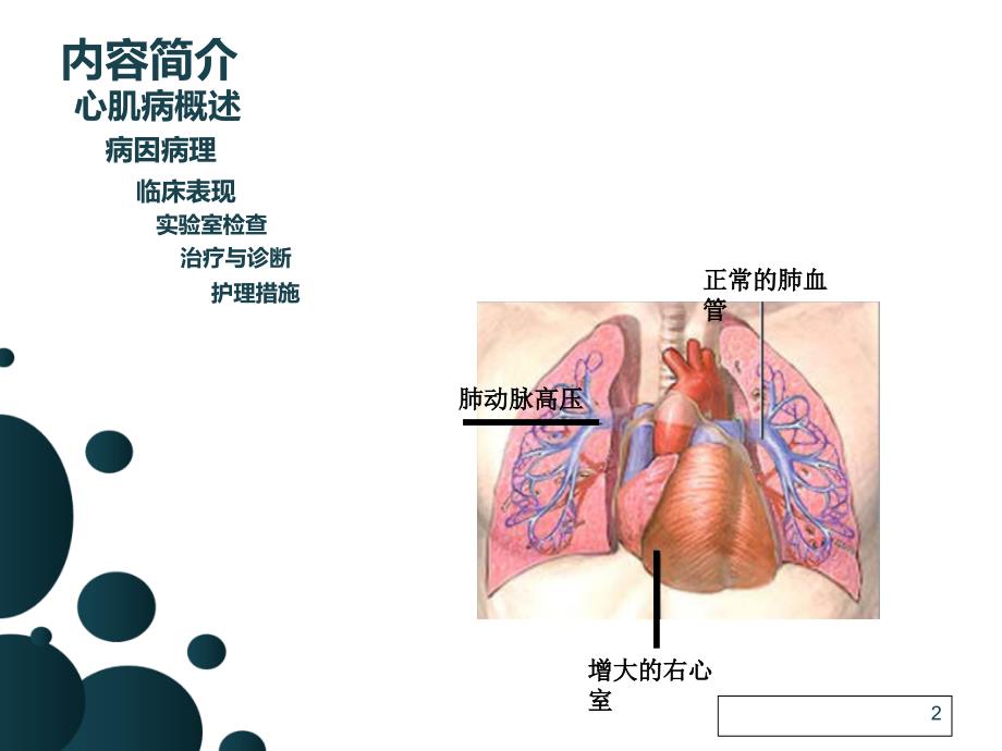 扩张性心肌病的护理查房张性_第2页