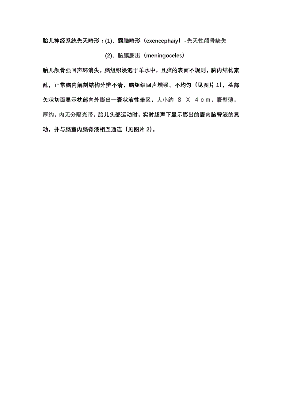 胎儿神经系统先天畸形_第1页