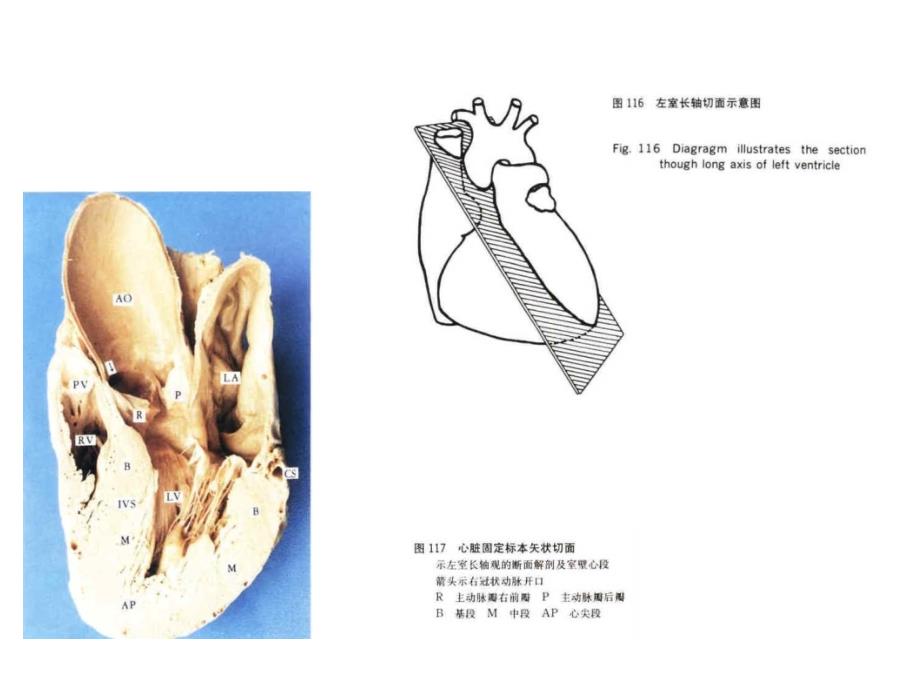 心脏超声与心脏断面解剖及室壁心段_第2页