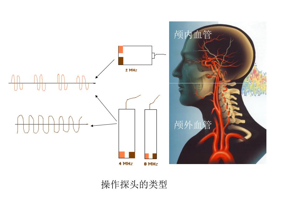 TCD教学系列幻灯片_第4页