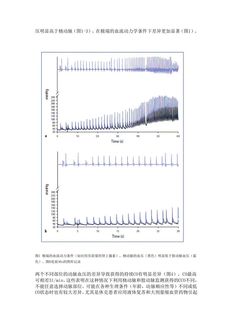 如何选择动脉血压监测的部位_第4页