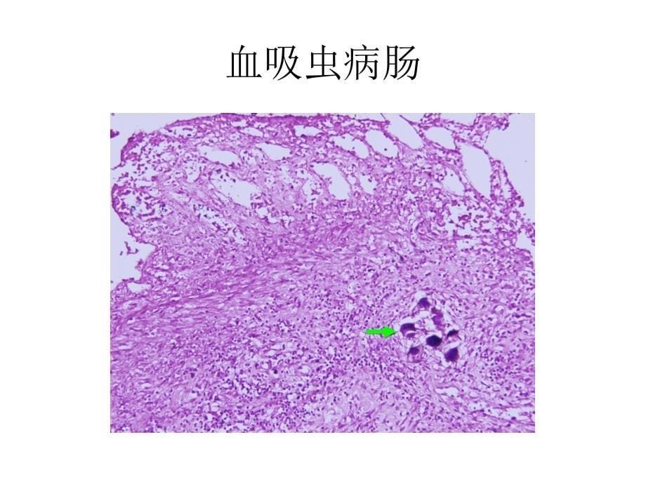 传染与寄生虫病_第5页