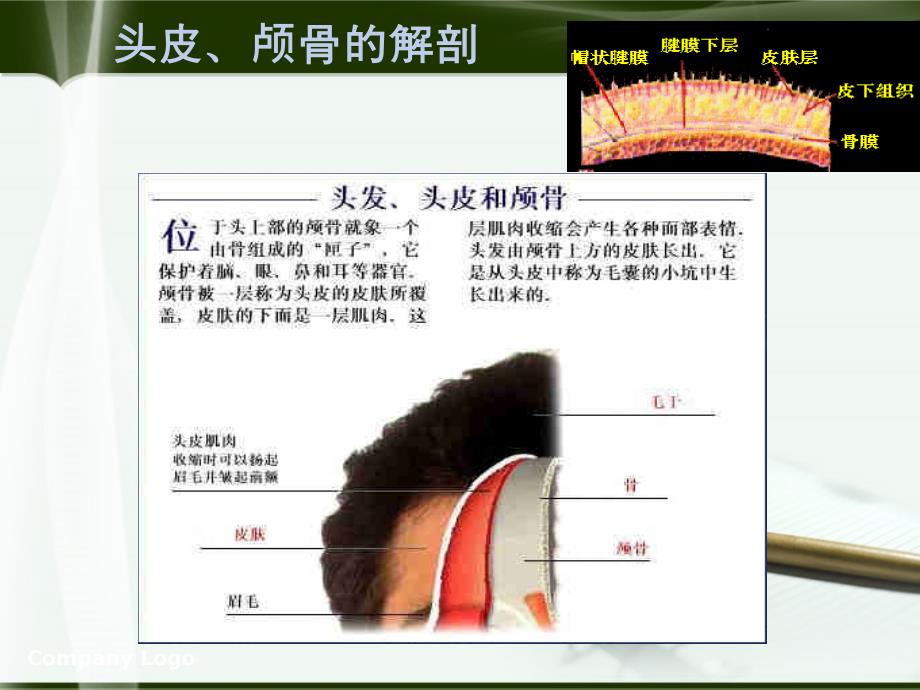 硬膜外血肿_第2页