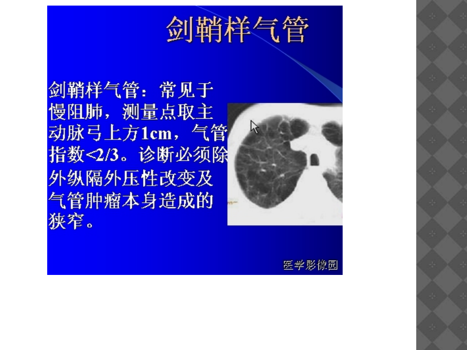 胸部病变分析_第3页