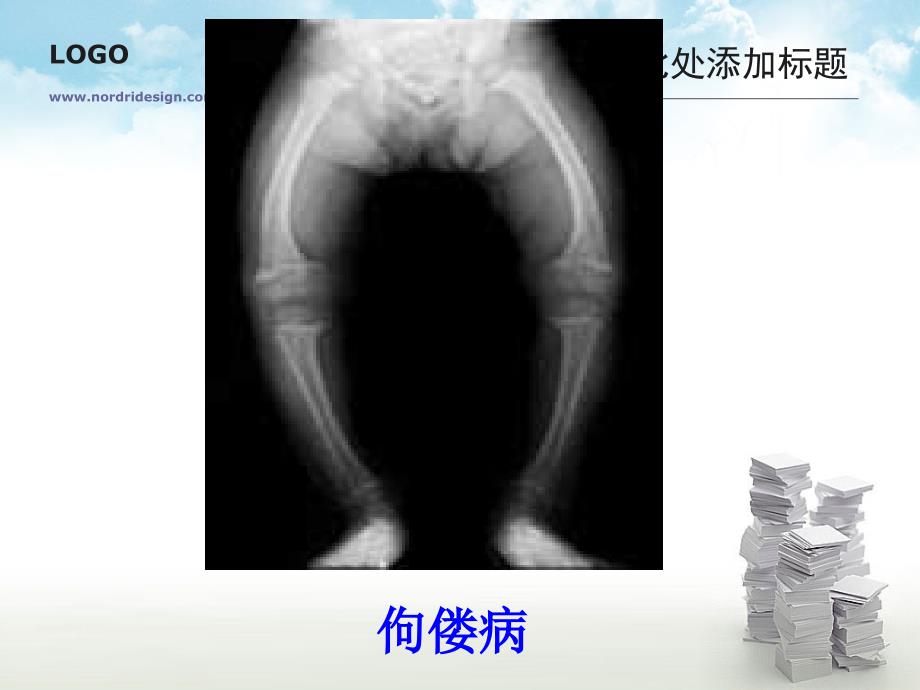 食物中的营养物质（2）_第3页