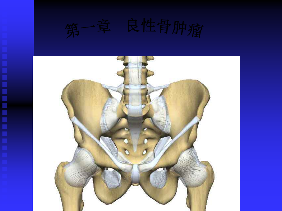 骨肿瘤X线病例图谱 2_第2页