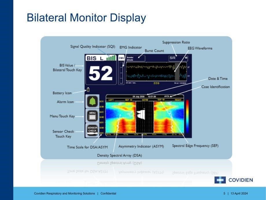 BIS Bilateral Monitoring Solutions_第5页