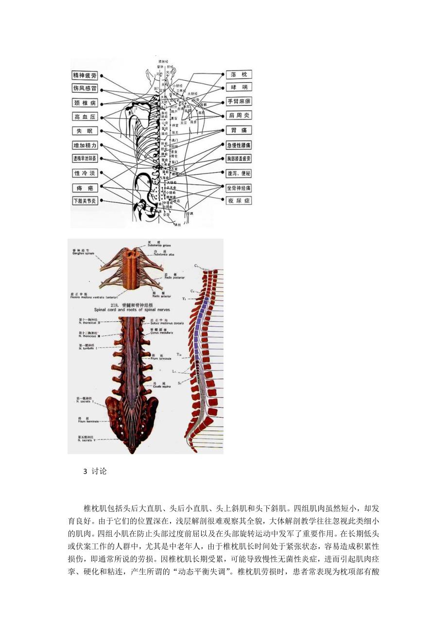 椎枕肌劳损的应用解剖及针刀治疗方案_第3页