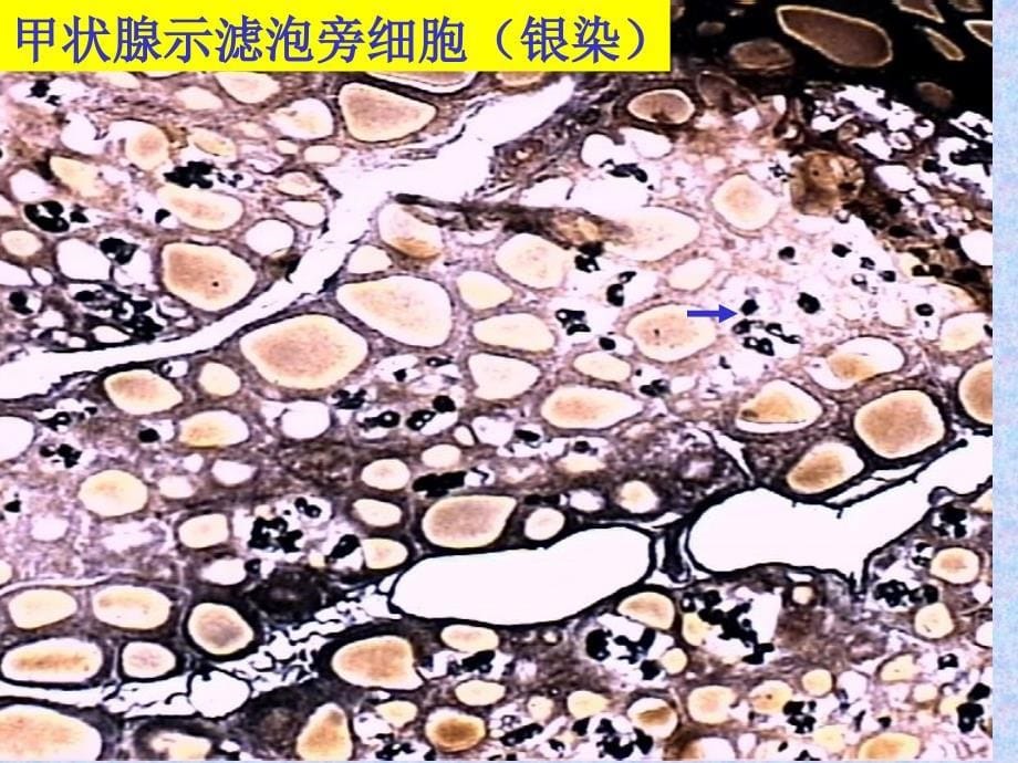 内分泌系统实习_第5页