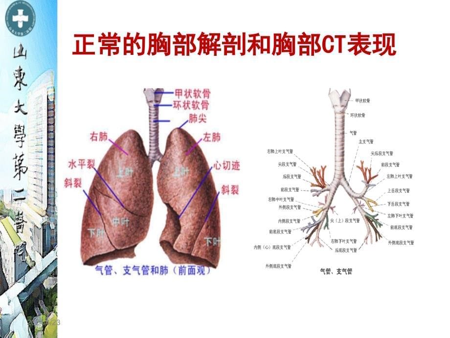 胸部CT的解读_第5页