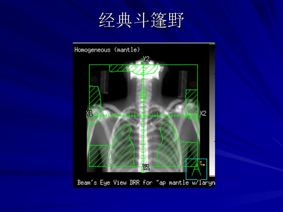 经典斗篷野_第1页