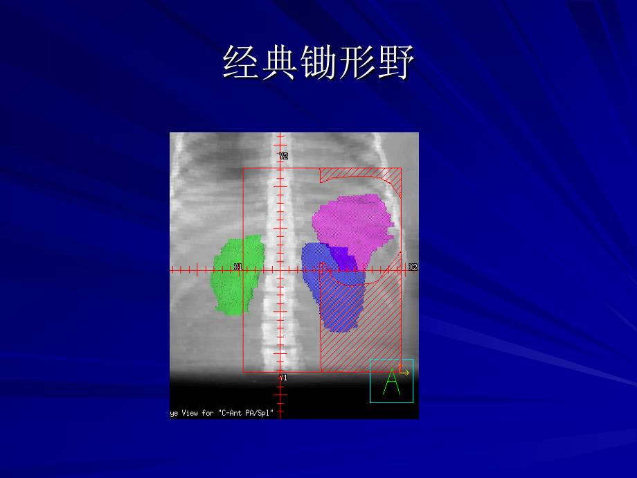 经典斗篷野_第2页