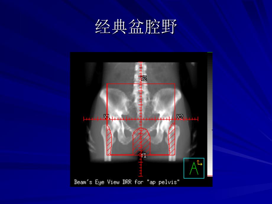 经典斗篷野_第3页