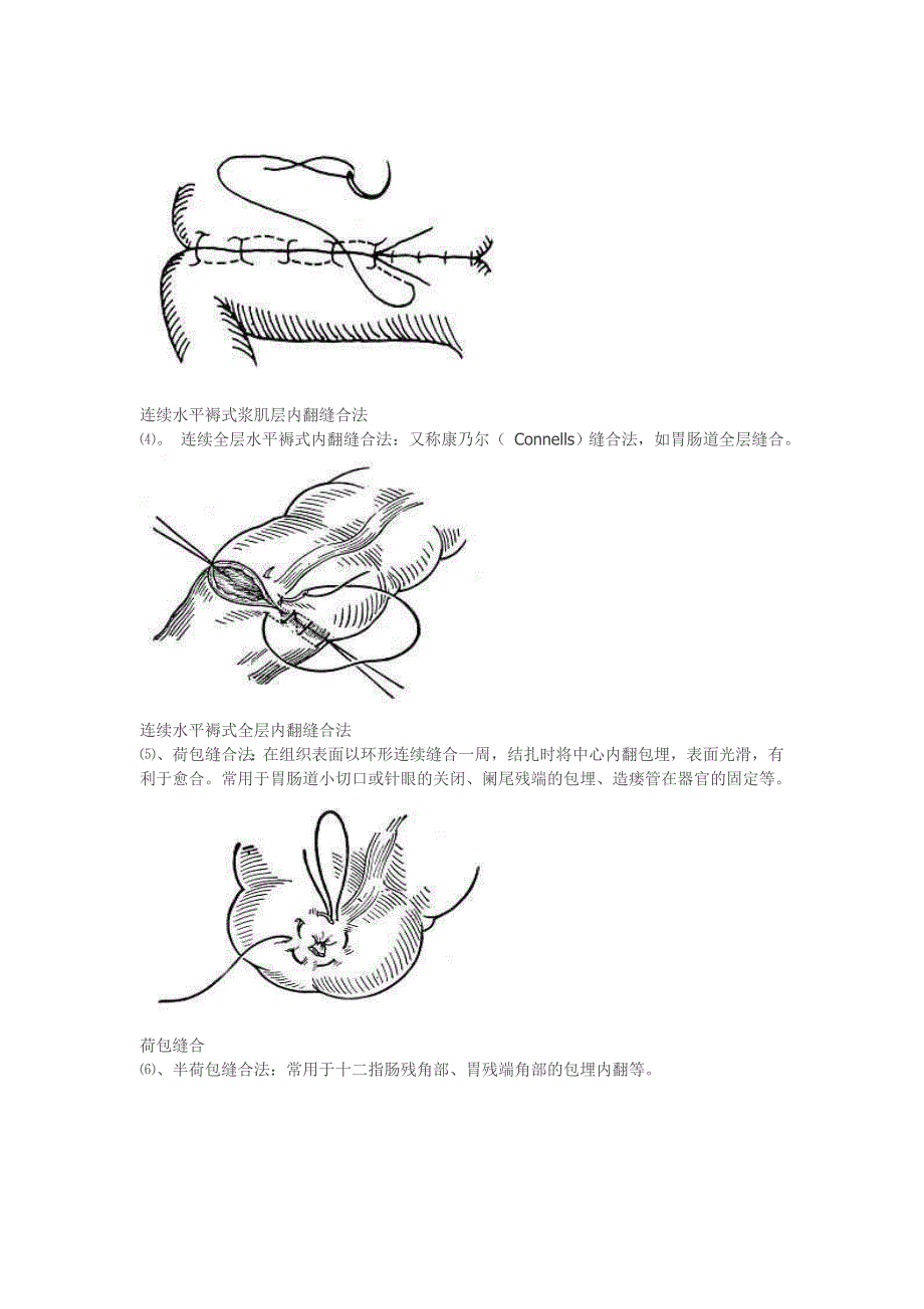 缝合技巧讲解_第4页