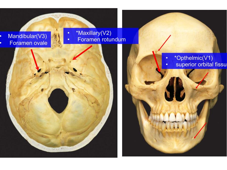 (神经解剖学)Trigeminal Nerve V_第4页