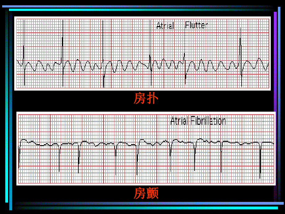 (药理学）自律性异常_第2页