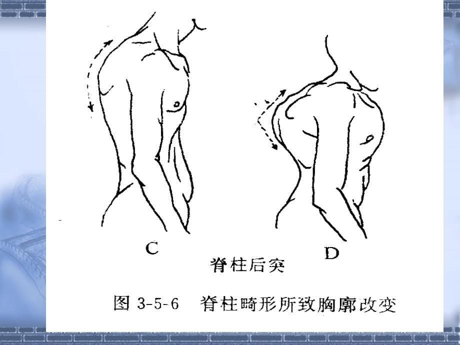 脊柱与四肢评估_第5页