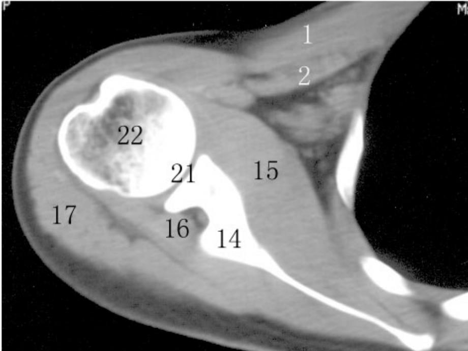 四肢断层解剖和ct、mri_第4页