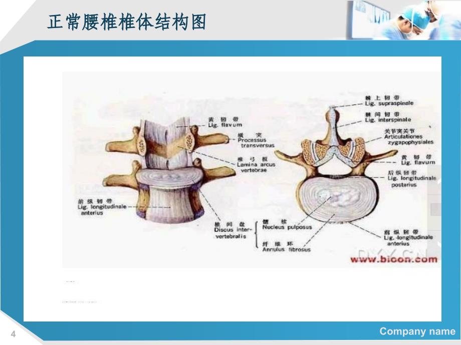 腰椎间盘炎围术期护理_第4页