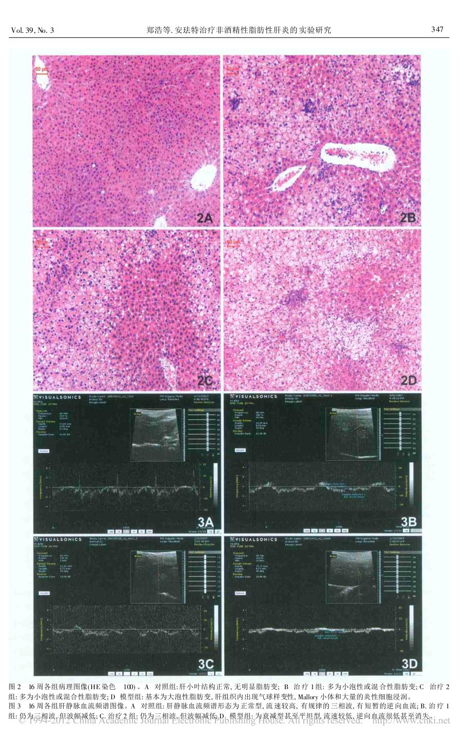 安珐特治疗非酒精性脂肪性肝炎的实验研究_第3页