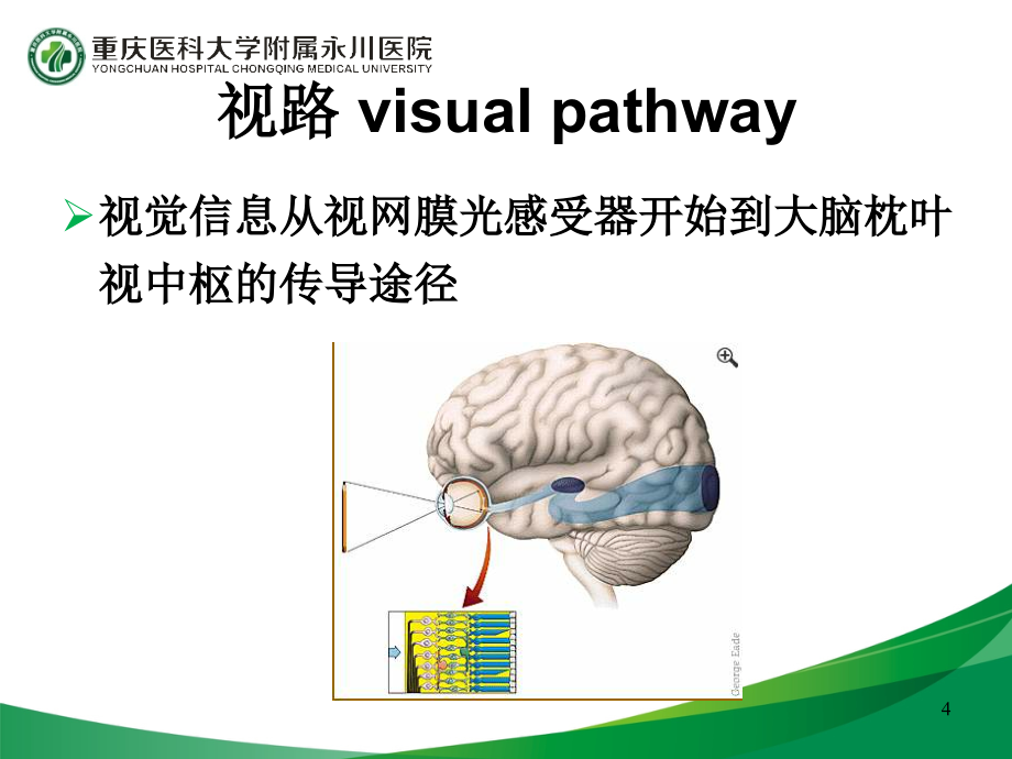 视神经与视路和眼眶病_第4页