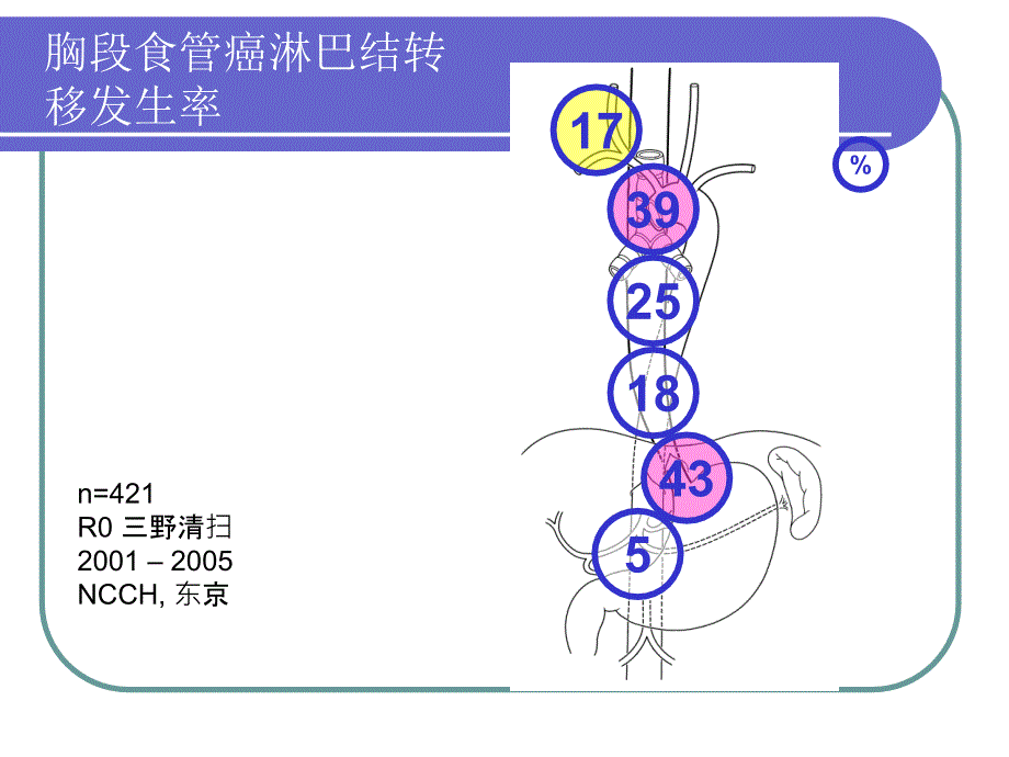 胸腹腔镜下食管癌切除术中胃的游离及胃周淋巴结清扫技巧_第3页